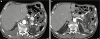 Abbildung 1b, c: MDCT