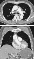 Abbildung 3: CT-Angiographie