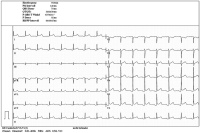 Abbildung 3: EKG