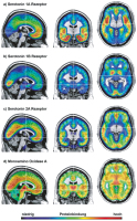 Abbildung 1a-d: Serotonin-Verteilung