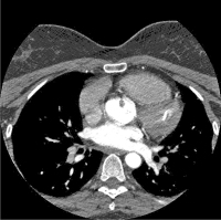 Abbildung 2: CT-Angiographie