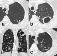 Abbildung 2a-c: Nocardia abscessus