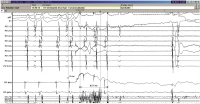 Abbildung 3: EKG