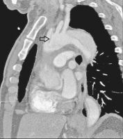 Abbildung 9: CT-Angiographie