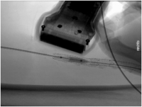 Abbildung 4: Radiologische Kontrolle
