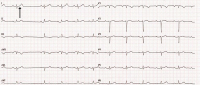 Abbildung 10: EKG