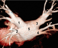 Abbildung 1: Multispiral CT
