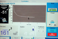 Abbildung 4: Cryoconsole display