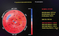 Abbildung 7: Bull`s Eye-Darstellung