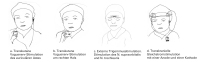 Abbildung 1: Neuromodulation