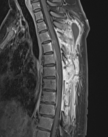 Abbildung 2: Postoperative MRT-Bildgebung