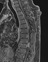 Abbildung 3: Postoperative MRT-Bildgebung