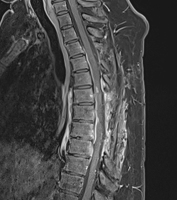 Abbildung 4: Postoperative MRT-Bildgebung