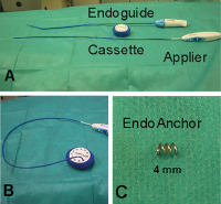 Abbildung 6: EndoAnchor
