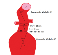 Abbildung 8: Hostile-neck-Anatomie 