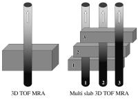 Abbildung 1: 3D-Time of Flight-Magnetresonanzangiographie