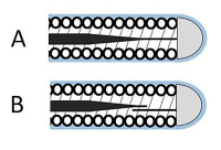Abbildung 2A-B: Tip Weld
