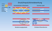 Abbildung 2: Druck/Impuls/Schneidewirkung