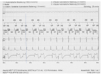Abbildung 2: EKG