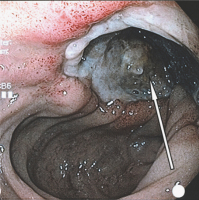 Abbildung 6:  Duodenum