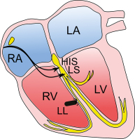 Abbildung 1: Antibradykardes System