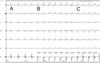 Abbildung 2: EKG