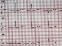 Abbildung 3: EKG