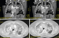 Abbildung 3: CT-Angiographie