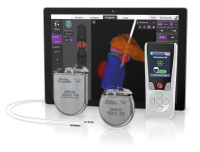 Abbildung 2: Produkt: DBS-Family<br>Vetrieb: Boston Scientific