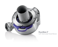 Abbildung 1: Produkt: HeartMate 3 LVAD-System<br>Vetrieb: Abbott Medical Austria GmbH