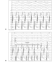 Abbildung 3: EKG
