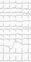 Abbildung 2: EKG