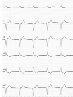 Abbildung 3: EKG