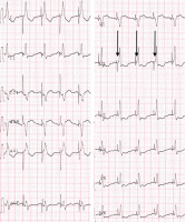 Abbildung 2: EKG