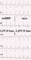 Abbildung 3: EKG