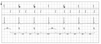 Abbildung 6: EKG