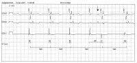 Abbildung 7: EKG