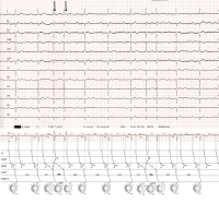 Abbildung 3: EKG