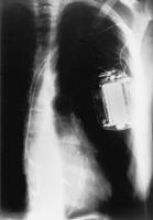 Figure 2: Jewel AF 7250