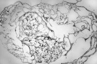Figure 2: Thrombus - Aspirin