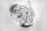 Figure 3: Thrombus - Aspirin