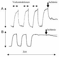 Abbildung 5A-B: Ischmie - Vasodilatation