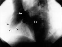 Figure 2: Mediastinale Masse