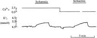 Figure 2: Kalium - Ischmie