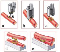 Abbildung 5a-e: Anastomosendevices