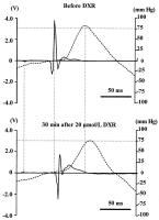 Figure 2: Doxorubicin - Angiotensin-II-Modulation