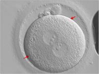 Abbildung 1: Zygote - Vorkernmuster