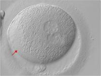 Abbildung 2: Zygote - Vorkernmuster