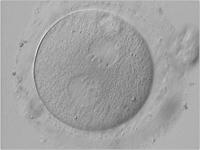 Abbildung 3: Zygote - Vorkernmuster