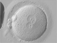 Abbildung 4: Zygote - Vorkernmuster